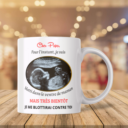 Mug Annonce Grossesse Personnalisable – Échographie Cadeau Surprise (A&C My Créa)