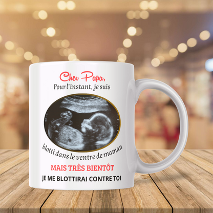 Mug Annonce Grossesse Personnalisable – Échographie Cadeau Surprise (A&C My Créa)